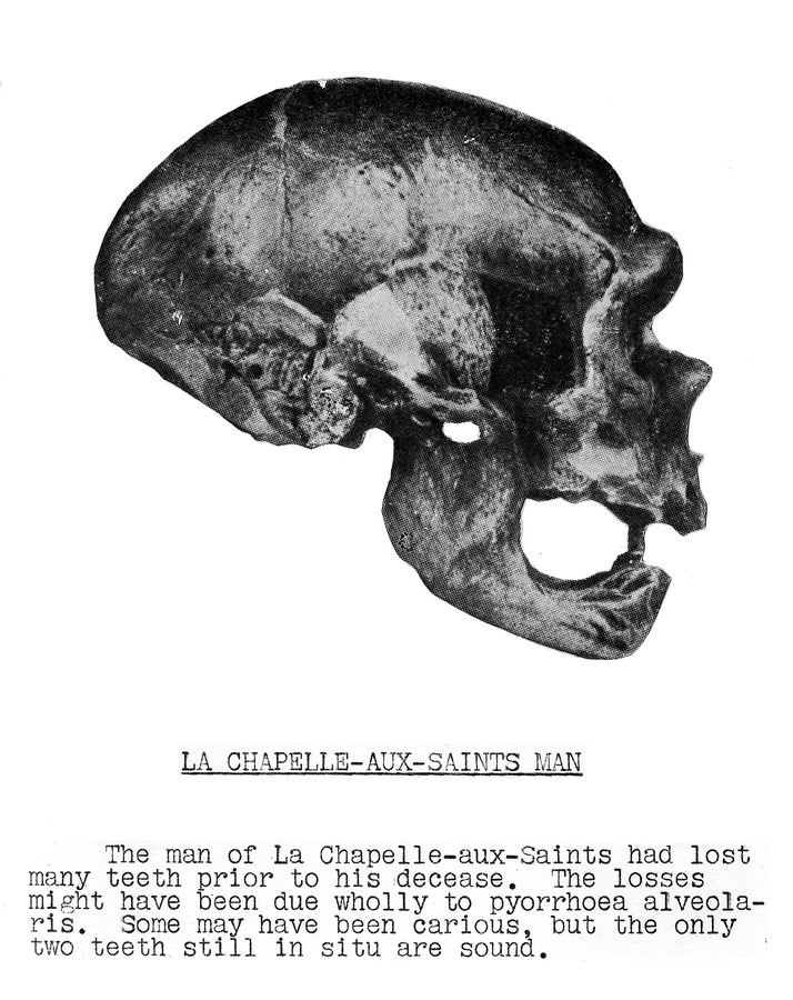 La Chapelle-aux-Saints 1 — 'the Old Man', Neanderthal — several possible faces — original
